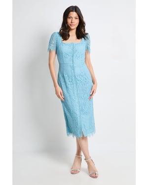 Lace Button Midi Dress