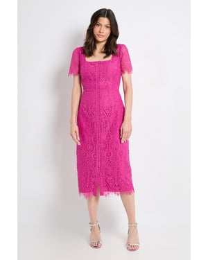 Lace Button Midi Dress