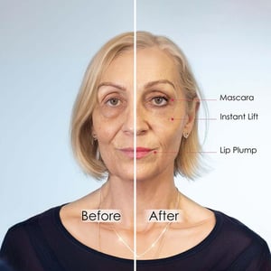 skinChemists Wrinkle Killer Instant Face Lift 5 x 2ml