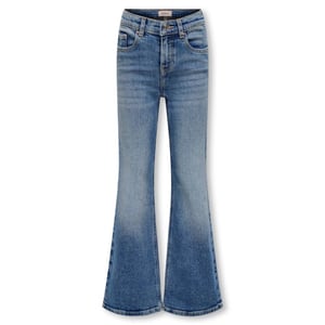 Only Jeans 15327051 kogjuicy