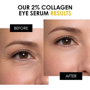 skinChemists Jeugdserie 2% Collageen Oogserum 15ml
