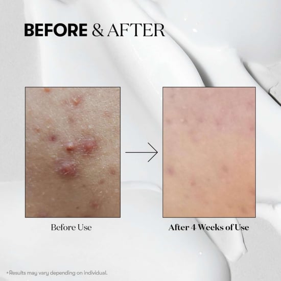 VT Cosmetics  Skincare Mild Reedle Shot 50 50ml - Image 3