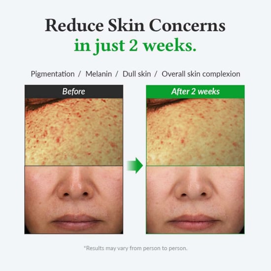 Dr.Althea Serums Gentle Vitamin C Serum 30ml - Image 4