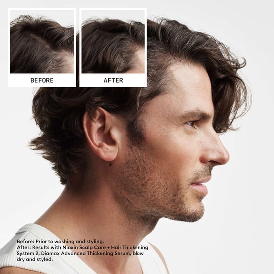 Nioxin Pro Clinical System 2 Trial Kit for Thinning Natural Hair - Image 6