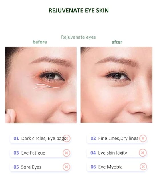 ErthSkin Eye Recovery Pro Massager - Image 2