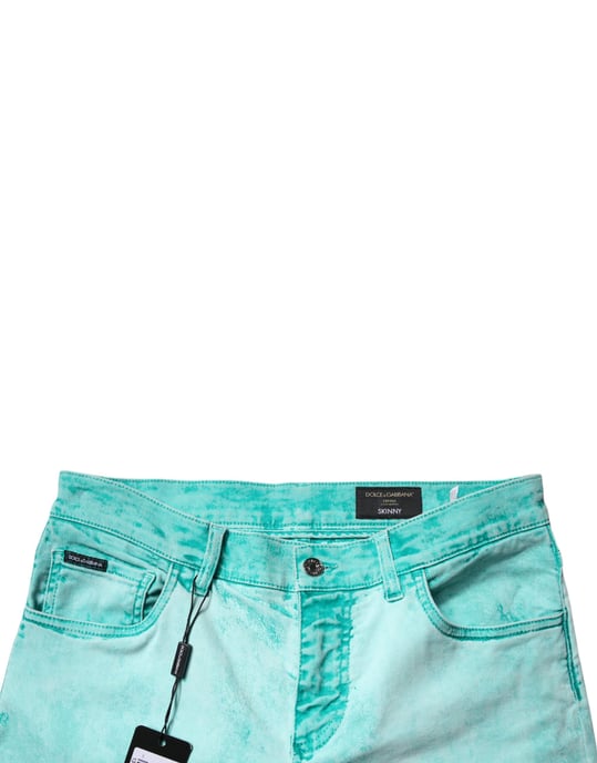 Slim Fit Acid Wash Jeans - Image 5