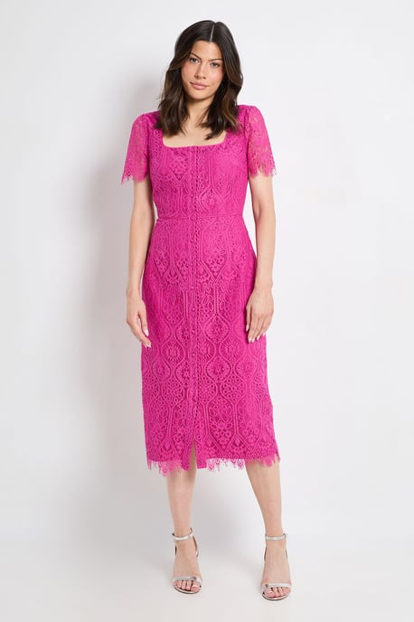 Lace Button Midi Dress - Image 1