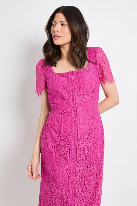 Lace Button Midi Dress - Image 2