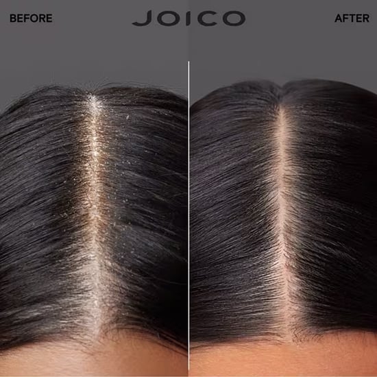 Joico Scalp Vitality Replenishing Essence 100ml Double - Image 4