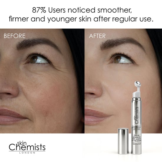 skinChemists Caviar Advanced Anti-Ageing Eye Treatment 15ml for Loss of Firmness, Fine Lines, Wrinkles - Image 3