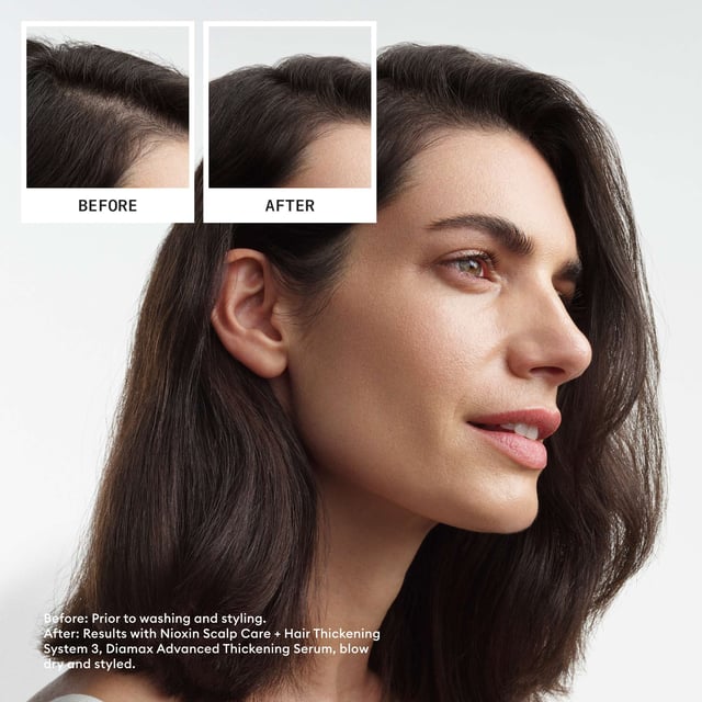 Discover the Nioxin Pro Clinical System 3 Trial Kit, expertly crafted for coloured hair experiencing light thinning. This clinically tested set revitalizes dry and damaged hair, enhancing thickness and strength to prevent breakage while safeguarding your vibrant colour. In just 30 days, 8 out of 10 users reported fuller, thicker hair! The kit includes: Nioxin Pro Clinical Scalp + Hair Shampoo (150ml), Conditioner (150ml), and Thickening Treatment (50ml). Key benefits include gentle cleansing, reduced breakage, and nourishing botanicals for scalp health.