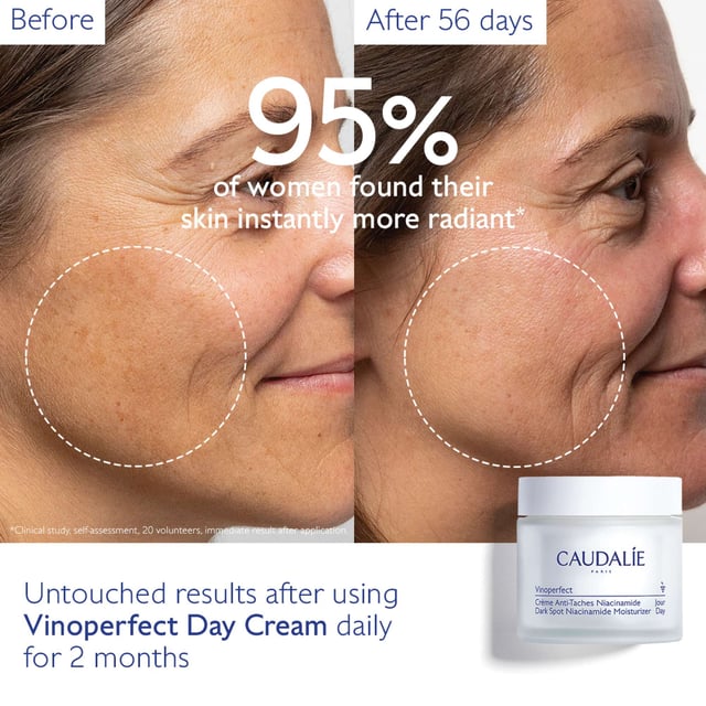 Experience radiant and hydrated skin with Caudalie Vinoperfect Niacinamide Moisturiser. This daily moisturizer brightens your complexion and reduces dark spots. Enriched with ViniferineTM, clinically proven to diminish pigmentation, and Niacinamide for enhanced brightening, it leaves your skin soft and luminous. With a 97% natural origin formulation, it offers immediate radiance, an even skin tone, and a hydrating cream texture. Apply generously after serum and massage for 2-3 minutes. Remember, this product is refillable. Join Caudalie in their commitment to sustainability.