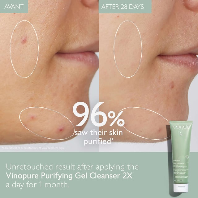Transform your skincare routine with Caudalie's Vinopure Purifying Gel Cleanser. This gentle yet effective formula is designed for breakout-prone skin, providing a thorough cleanse without dryness. Infused with natural salicylic acid and prebiotic organic grape water, it helps regulate sebum production and tighten pores. Ideal for daily use, this vegan and certified organic cleanser is free from soap and synthetic fragrances. Caudalie also contributes 1% of its turnover to environmental causes. Achieve a clearer complexion with a non-comedogenic formula that refreshes and purifies your skin.