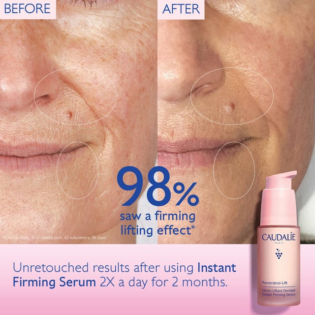 Discover the Caudalie Resveratrol-Lift Instant Firming Serum Refill, an eco-friendly choice for your skincare. This anti-aging serum is three times more effective than retinol, providing lifting and smoothing effects. With plant-based vegan collagen, micro hyaluronic acid, and peptides, it targets fine lines and wrinkles. Its lightweight texture is ideal for makeup layering, and the refillable packaging promotes sustainability. With 98% natural ingredients, Caudalie is committed to positive environmental impact. Transform your skin with this innovative serum.