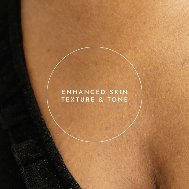 Discover the benefits of Fushi Really Good Stretch Mark Oil, specially formulated to help prevent and reduce stretch marks during pregnancy. This luxurious blend targets uneven skin with powerful ingredients. Pomegranate oil fades scars, while avocado oil promotes elasticity and hydrates. Wheatgerm oil, rich in Vitamin E, aids skin repair. Infused with healing tulsi, this oil enhances your skin's natural health. For optimal results, massage daily into damp skin after bathing. Embrace self-care with Ayurvedic rituals that celebrate your body.
